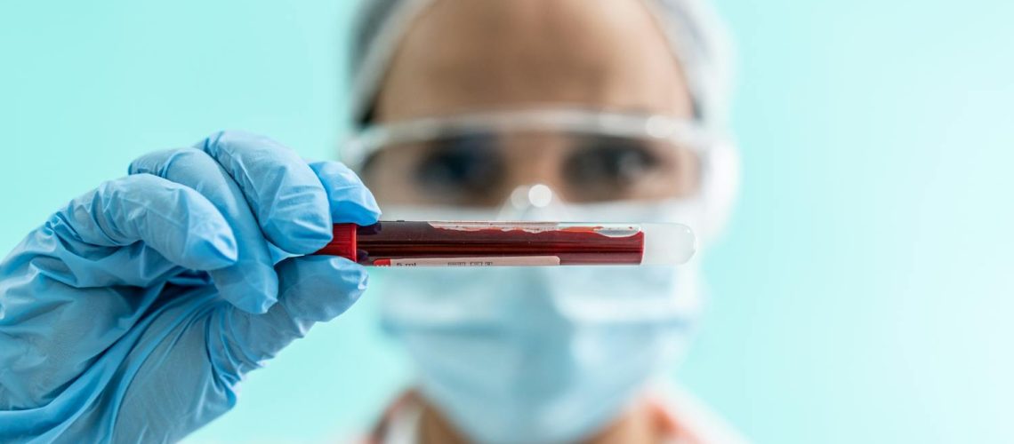 Qu’est-ce que la TCMH et comment interpréter cette valeur ? Qu'est-ce que la TCMH et comment interpréter cette valeur ?